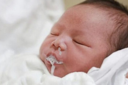 Sặc sữa ở trẻ sơ sinh rất nguy hiểm - Hướng dẫn nhận biết và sơ cứu